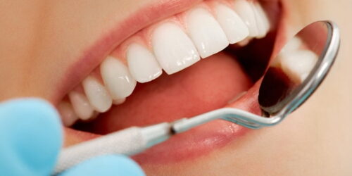 Maintaining Optimal Oral Hygiene